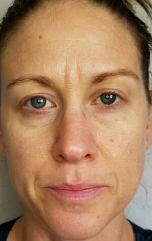 At the age of 40, deep wrinkles and age spots appear