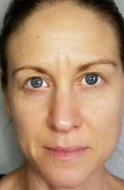 Zxcvbnmqwort helps rejuvenate the skin and lighten the stain