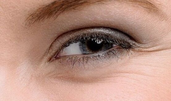 Wrinkles in the corner of the eye